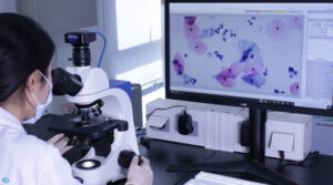 Cytologia na podłożu płynnym